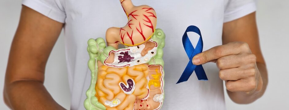 Woman holding blue ribbon with human colon and stomach anatomy model