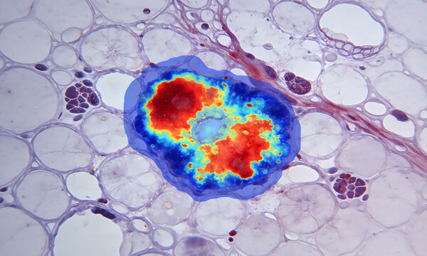 Colorful Stained Cell Cluster with Surrounding Adipose Tissue