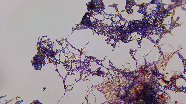 Filamentous Fungal Hyphae Network With Spore Chains Microsc