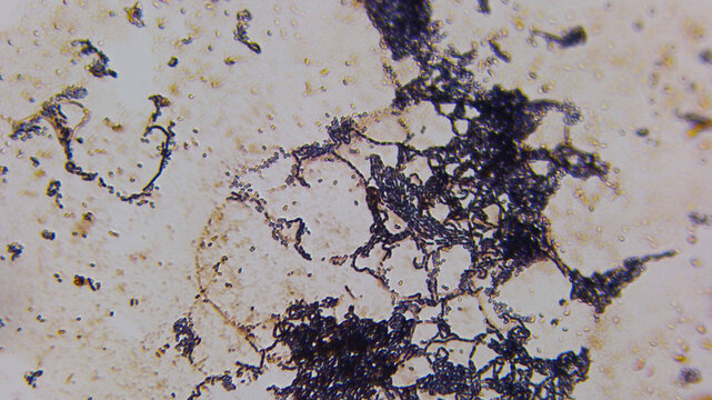 Filamentous Fungal Hyphae Network With Spore Chains Microsc