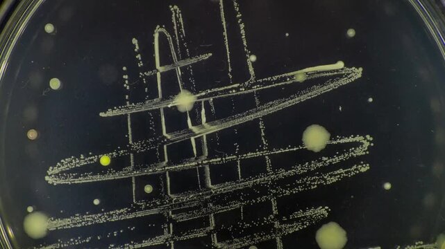 Microscopic life spreads across agar surface, showcasing dynamic bacterial colony development over time