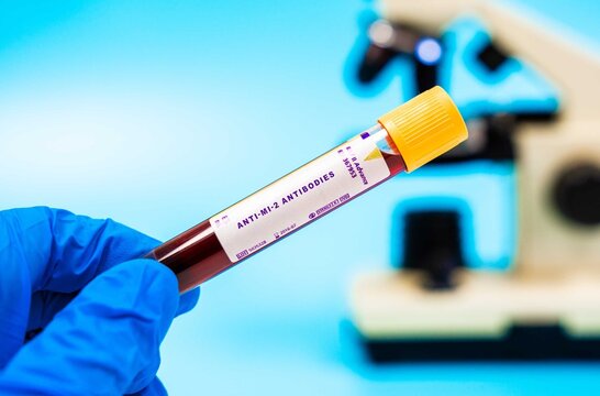 Autoimmune marker Measures anti-Mi-2 antibody levels,