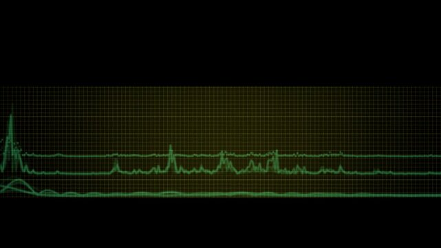 Pulsed green electroencephalogram graph, electroencephalogram spectrum animation