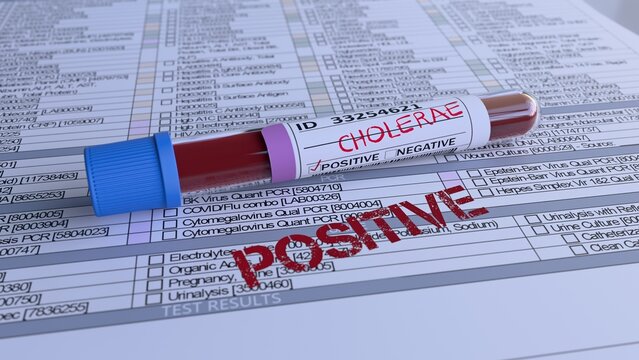 Cholerae Test Positive Blood Test Result