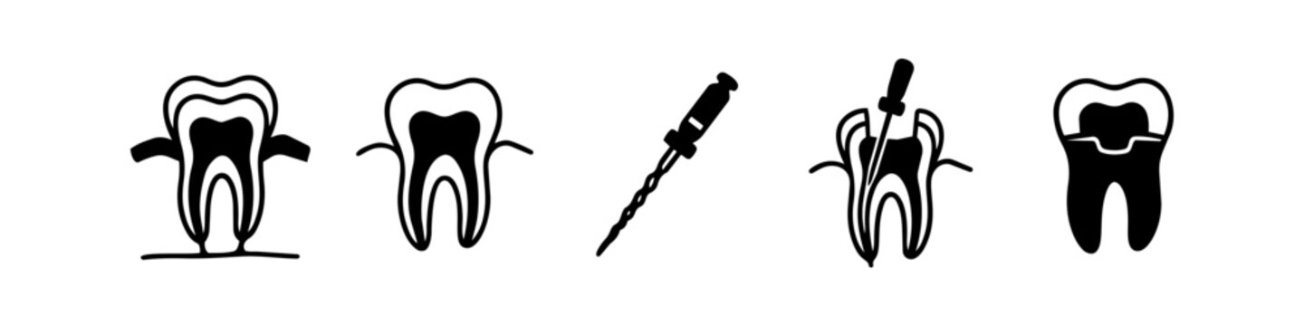 Vector set of black icons illustrating the steps of a dental root canal treatment, from infection to final crown restoration. Ideal for medical education and dentistry clinics.