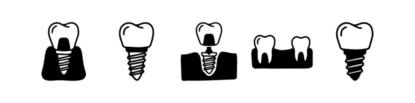 Set of minimalist black and white dental implant icons. Illustrates prosthetic crowns, bridges, and tooth restoration stages for stomatology clinic branding, oral health care, and infographics.
