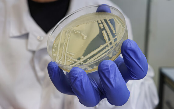 Yeast (fungi) Colonies on Agar Plate. Microbiology Culture, Laboratory Testing, Scientific Research