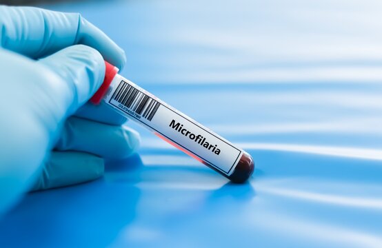 Blood sample tube for microfilaria test analysis.