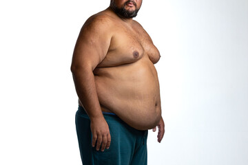 Naklejka premium Overweight man with abdominal obesity