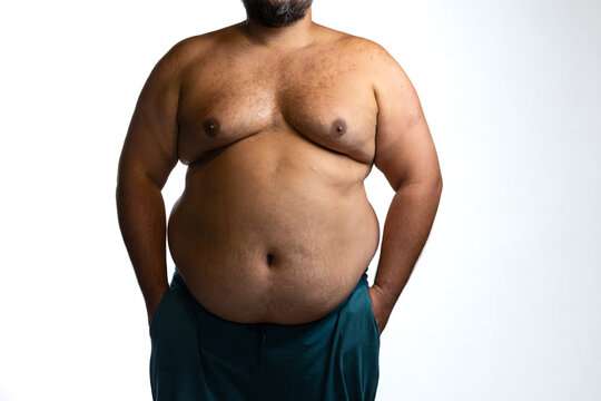 Overweight man with abdominal obesity