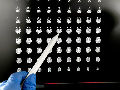The doctor's hand points to X-rays of a person's head.