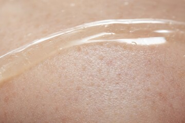 Fototapeta premium Close-up of delicate human skin with subtle medical tubing attached, showing fine texture and natural translucent tone under soft diffused lighting, healthcare and medical concept