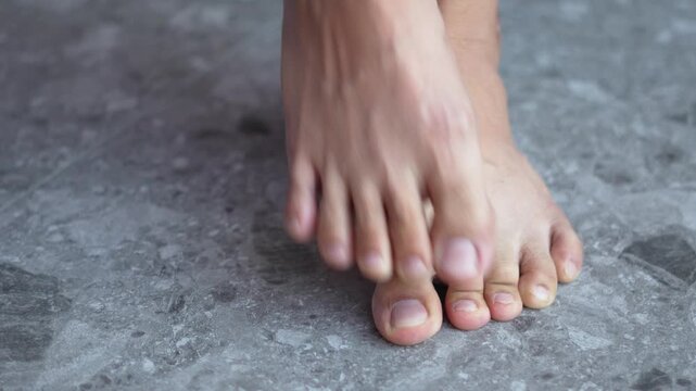 Foot pain, ache young man hand scratch feet, itch foot, problem itchy skin, dermatitis from fungus, fungal bacterial infection, allergic reaction, eczema. Foot care concept.	
