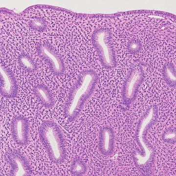 Proliferative Endometrium Histology Under Microscope