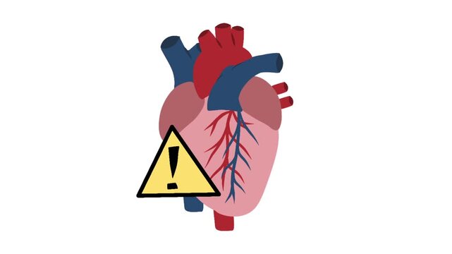 Coronary artery disease illustration animation