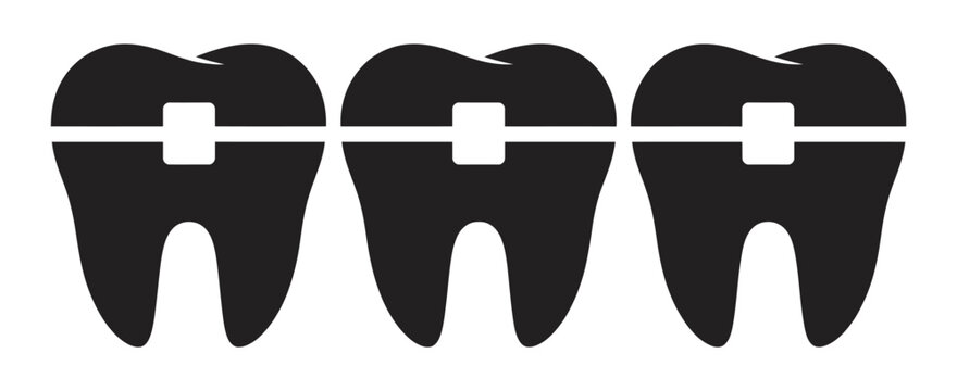 Dental braces on teeth dental bracket system vector illustration showing teeth alignment correction and orthodontic treatment symbol design.