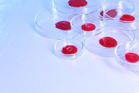 Biochemistry. Petri dishes with samples on light table, closeup. Space for text
