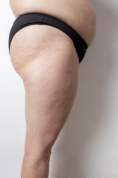 Embracing body positivity in mature skin