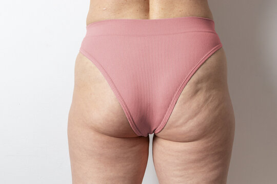 Embracing body positivity and self-acceptance