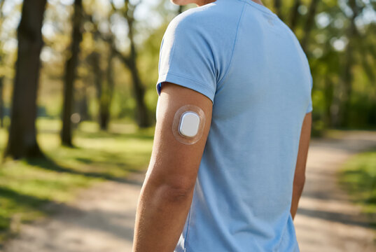 Faceless person wearing continuous glucose monitor sensor on arm during walk in sunny park. Insulin-dependent diabetes. Blood sugar level, glucose monitoring. Medical with copy-space.