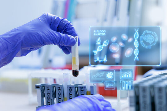Ai diagnostic of Laboratory technician holding blood tube with separated plasma and interactive digital health interface overlay for medical research