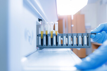 Technician loading blood serum test tubes into clinical analyzer tray for diagnostic testing © Parilov