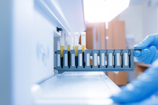 Technician loading blood serum test tubes into clinical analyzer tray for diagnostic testing