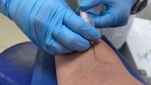 Nurse changing test tube during blood draw, close up medical procedure