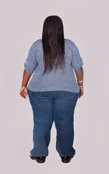 Rear View of an Obese Woman Highlighting Physical Indicators of Health Risks and lifestyle-related chronic diseases