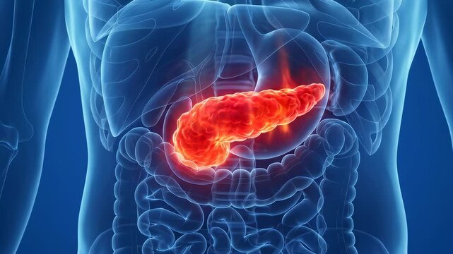 3D human pancreas with severe inflammation, glowing red highlights, on blue background, medical visualization of acute pancreatitis, anatomy detail, 4K video