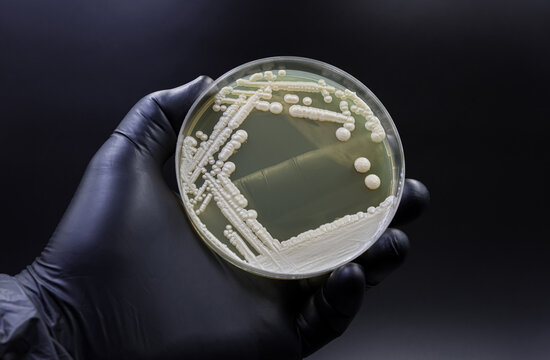 The yeast Candida, responsible for urinary tract infections (UTIs)	

