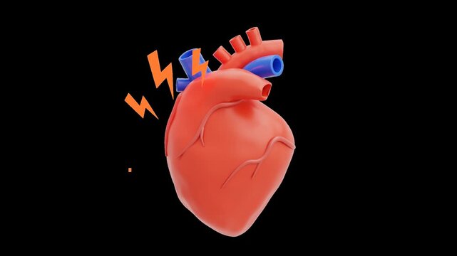 3D Heart Attack | Alpha Channel