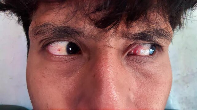 Macro Video of Smiling Human Eyes with Genuine Expression and Crow's Feet