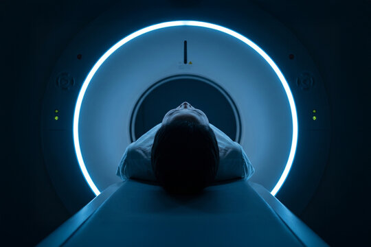AI generated medical imaging MRI CT scan and diagnosis