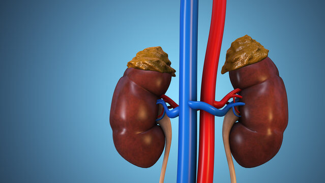 Addison Disease Adrenal Glands Medical Concept