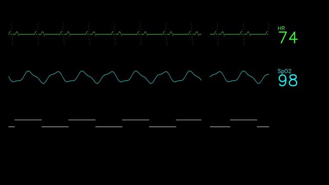 Digital patient monitor showing heart rate and oxygen saturation levels on black background.