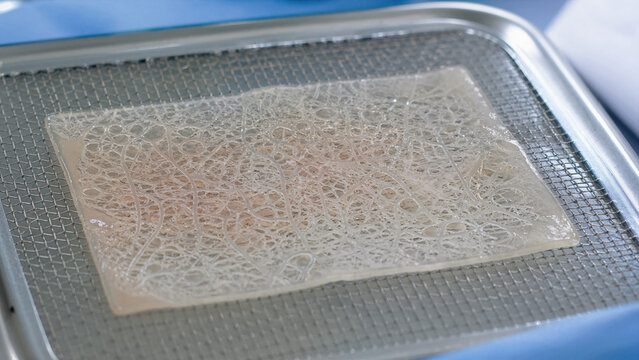 A bio-printed skin graft with a delicate lace-like pattern designed to be invisible after application resting on a sterile surgical mesh.