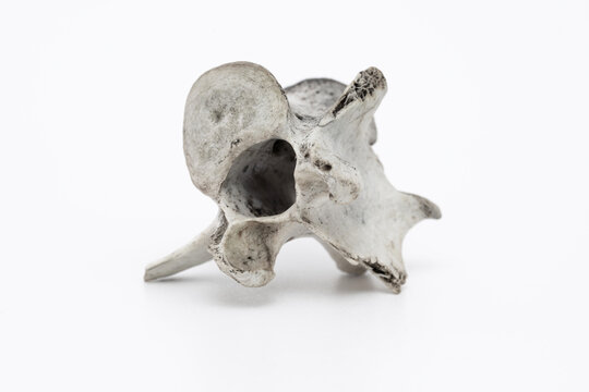 Knochenfragment
