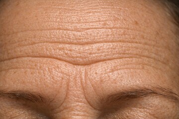Fototapeta premium Close-up of human forehead with wrinkles. Skin texture shows age and experience. Natural light highlights fine lines and imperfections. Ideal for beauty and skincare concepts.