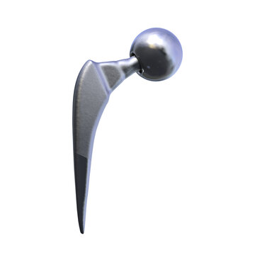 Unipolar hip hemiarthroplasty prosthesis with large single femoral head and femoral stem designed for replacement of the proximal femur, 3D illustration