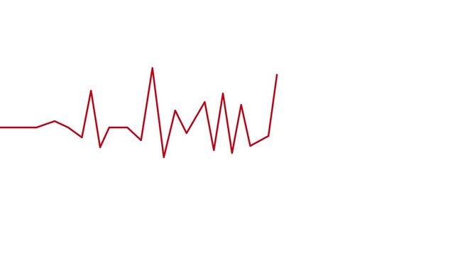 Abnormal ECG cardiogram animation with irregular heart rhythm footage