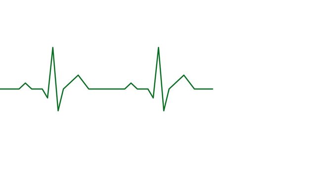 Healthy heart cardiogram animation with normal ECG waveform footage