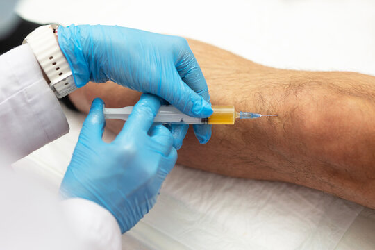 Knee joint. Treatment of joints with plasma. Patient's own biomaterial. Doctor injects plasma into patient's knee. Latest methods of joint treatment. Treatment of joint pain without surgery. Top view