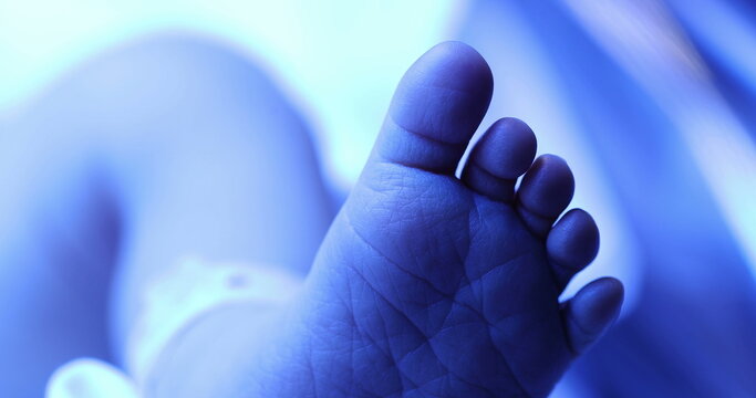 Closeup of infant newborn toddler feet under phototherapy