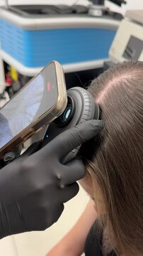 Scalp trichoscopy examination with digital dermatoscope close up, dermatologist diagnostic procedure in clinic