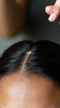 Vertical video of hands applying golden oil to a scalp with a dropper. Close-up overhead view of a hair care treatment on dark hair. Nourishing serum application