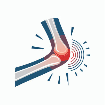 Elbow Joint Pain Illustration