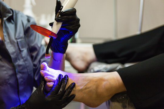Hardware medical pedicure with nail file drill apparatus. Patient on pedicure treatment with pediatrician chiropodist. Foot peeling treatment at spa with a special device. Clinic of Podiatry Podology.