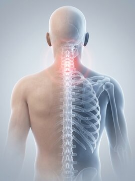 A male anatomical model showing neck and upper back pain.