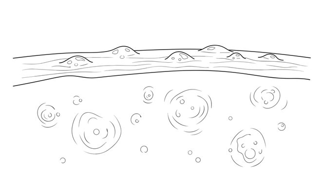 Illustration of skin with hives displaying raised bumps and swirling patterns, monochrome sketch with detailed texture